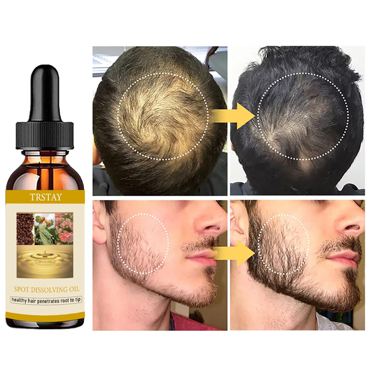 50ML huile de croissance de ba - Beard Oil avis et prix